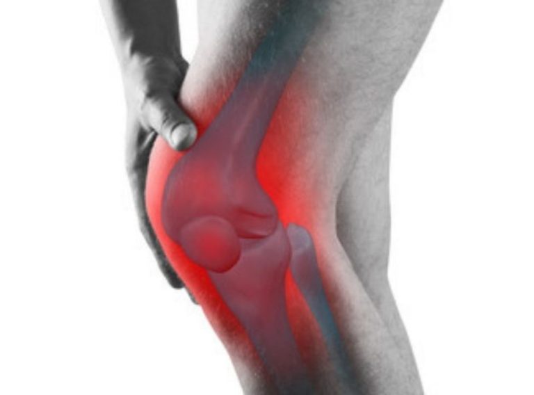 i-sintomi-della-sindrome-femoro-rotulea-1024x576