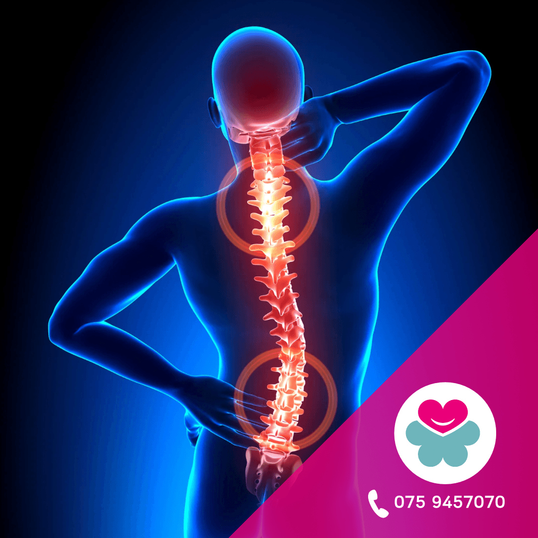 Clinica della colonna