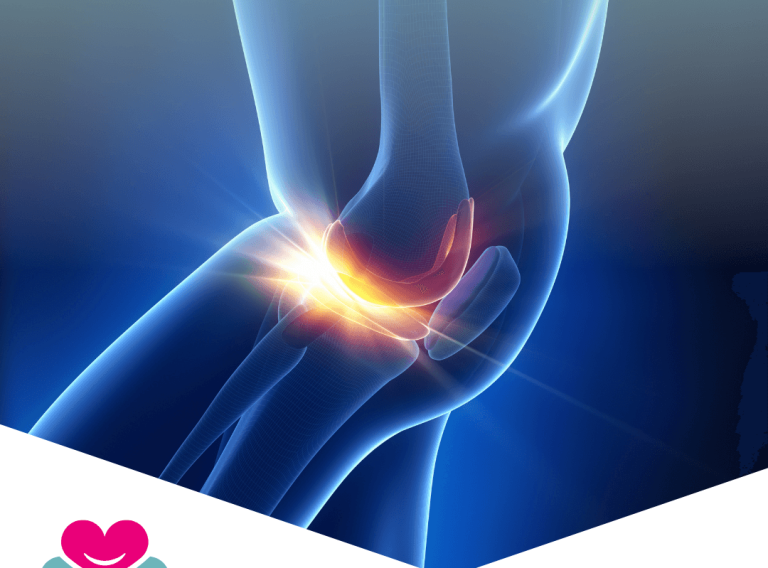 Rottura del menisco? Non è sempre una condanna al bisturi