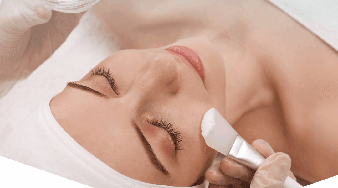 peeling viso