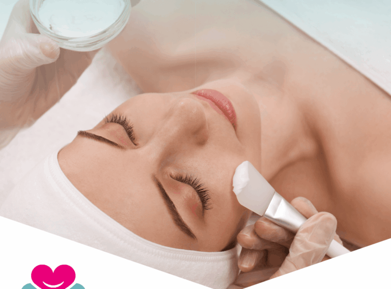 peeling viso