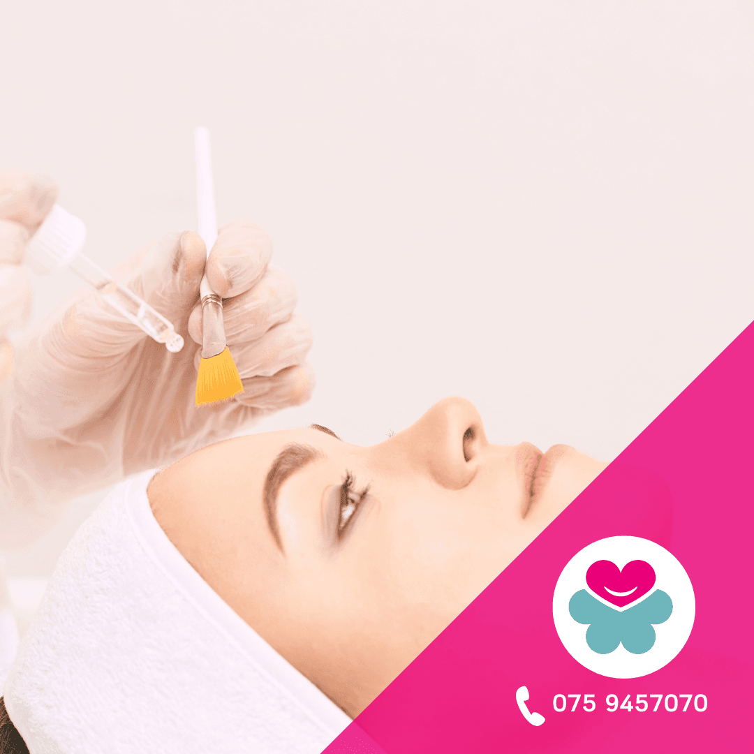 peeling viso